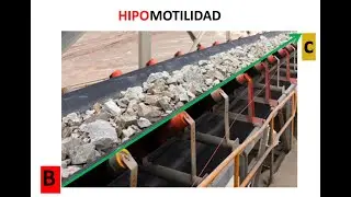 CONSTIPACION FUNCIONAL Por qué sucede?