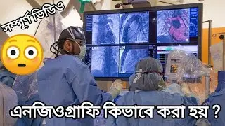 এনজিওগ্রাম কিভাবে করে ? 😳              এনজিওগ্রাফি সম্পূর্ণ ভিডিও