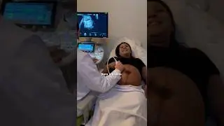 Fiz ultrassom para ver a Maitê na Medicina Fetal Hospital Santa Cruz Curitiba