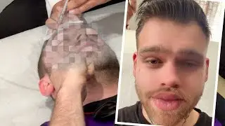 I Got Instagram Model Injections