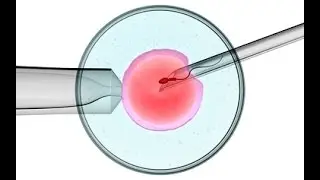 How is Egg Fertilization Done with Sperm? - Op. Dr. Emre Karatekelioğlu
