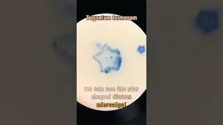 Ocean Star Algae (Under a Microscope)