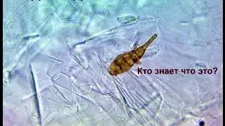 Мёд под микроскопом 2000x