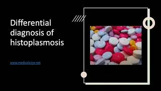 Medical Zone - Differential diagnosis of histoplasmosis  2