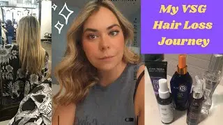 My VSG Hair Loss Journey