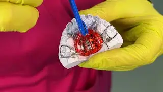 КАК ПОЛЬЗОВАТЬСЯ АППАРАТОМ - ПЛАСТИНКОЙ МАРКО РОСА 🦷