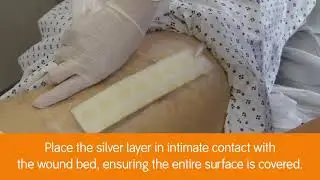 ACTICOAT Antimicrobial Dressing Application - Incision on Hip