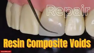 This is how you REPAIR composite voids!