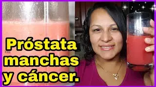 PROBLEMAS DE PRÓSTATA, DEL CORAZÓN, MANCHAS Y PREVIENE EL CÁNCER CON ÉSTE BATIDO - Zara Martínez