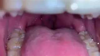 Inside my mouth , tonsils, uvula and tongue | VORE VIDEO