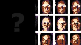 Who is prosopagnosia?
