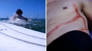 This Man Survived MULTIPLE Stings From Oceans Most Venomous Creature