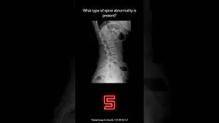 Musculoskeletal X-ray Question 32