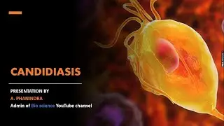 Candidiasis | Vaginal candidiasis, Cutaneous candidiasis, Oral candidiasis | Causes and Symptoms