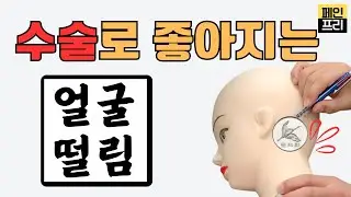 얼굴떨림(경련)의 이유와 치료, 반측성 안면 경련, 눈떨림  hemifacial spasm, MVD #신경외과 #눈떨림 #눈꺼풀떨림 #뇌졸중 #뇌경색 #안면마비 #MVD