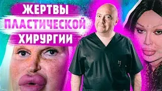 Жертвы пластической хирургии