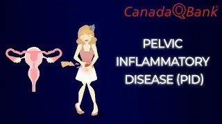 Pelvic Inflammatory Disease Explained | Causes, Diagnosis & Treatment | CanadaQBank