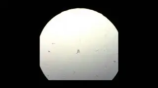 соли в моче 