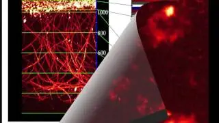 Deep Vascular Imaging in Wounds by Two-Photon Fluorescence Microscopy