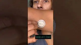 Let’s have a look inside Dexcom G7 👀 
