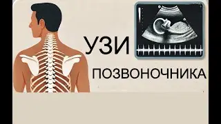 УЗИ Позвоночника