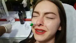 Septum Piercing Deldirme Sonrası Koku Neden Olur?