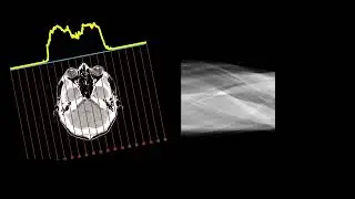 X-ray tomography sinogram build-up