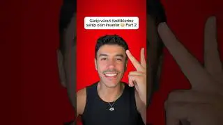 Garip vücut özelliklerine sahip insanlar 😳 | Part 2 #garip #ilginç #iemiqa #emiqa #vücut