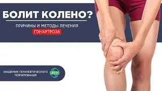 Гонартроз I Тейпирование коленного сустава