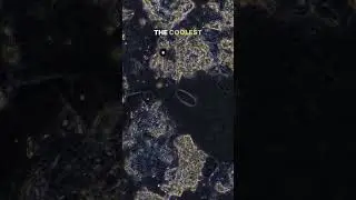 Eye Boogers Under Microscope 