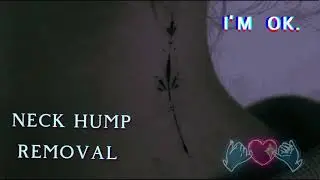 neck hump removal subliminal