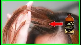 Castor Oil For Hair Growth - How To Use It? | Best Home Remedies