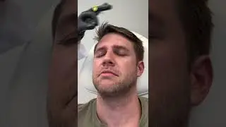 Botox for men