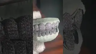 White gold vvs grillz by Seattle Gold Grills.  