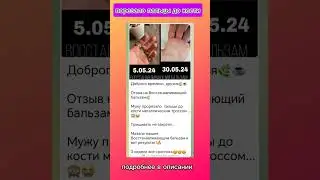 порезало пальцы до кости #сибирскоездоровье #восстановлениекожи #восстанавливающийбальзам