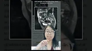 What happens to the *space* where the uterus was after a HYSTERECTOMY? Gynecologist Explains! 