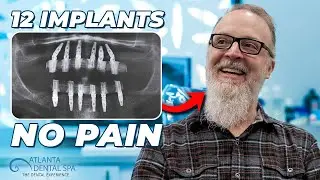12 Implants, No Pain (Full Mouth Restoration)