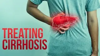 Apollo Hospitals | All you need to know about Cirrhosis  | Dr. Hitendra K Garg