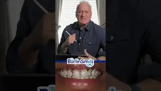 A stunning prep-less transformation with Durathin Veneers