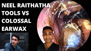 The Neel Raithatha Tools VS Colossal Earwax Blockage (First Impressions)
