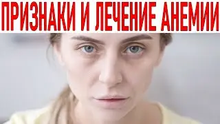 СИМПТОМЫ АНЕМИИ Как устранить дефицит железа в организме Чем опасна анемия