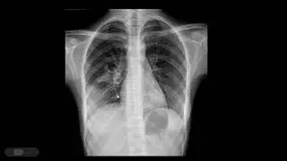 Learning Cases (on Radiographs) by Senior Resident Dr. Chandrika