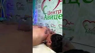 Кровопускание 