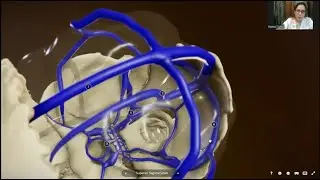 Meninges and Dural Venous Sinuses