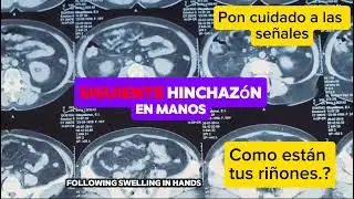 Epigenetica y riñones