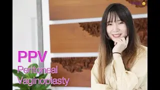 Hu Sanmiao shares her SRS-PPV experience at Kamol Hospital