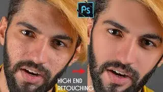 High-End Retouching of Rough Skin Easy & Faster Manually in Photoshop