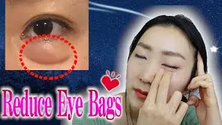 🌛10min Magic Massage to Reduce Under Eye Bags While You Sleep: Insomnia Relief/ Fall Asleep Fast