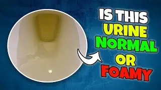 How to Know If Urine is Foamy or Normal