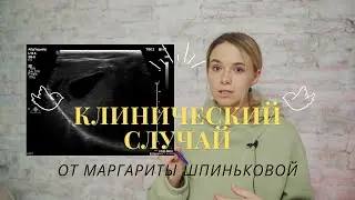 Интересный клинический случай